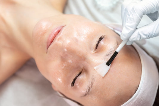 Common Types of Chemical Peels