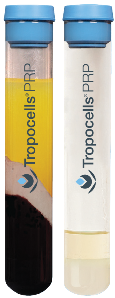 Tropocells™ PRP Blood Collection Tube, 22 ml