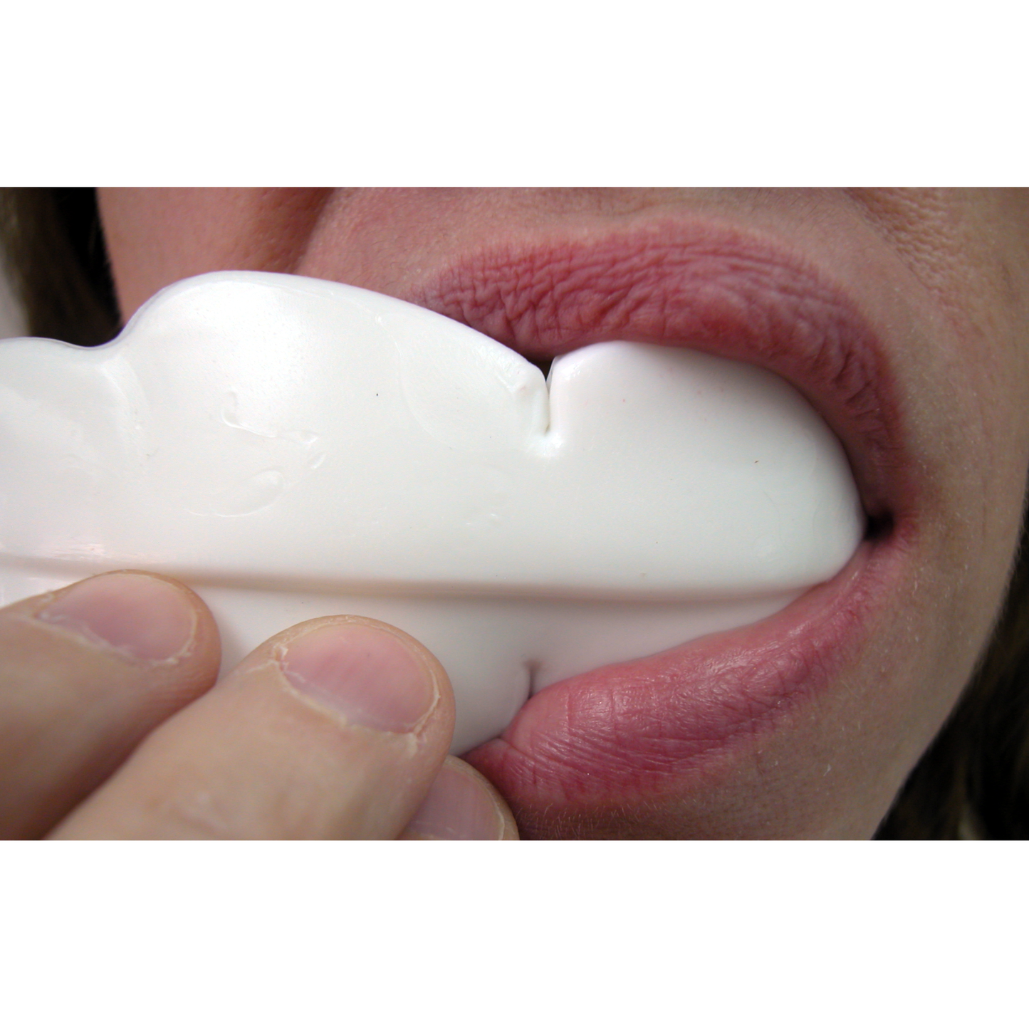 Oculo-Plastik 60-104 OPSoft MouthGuard