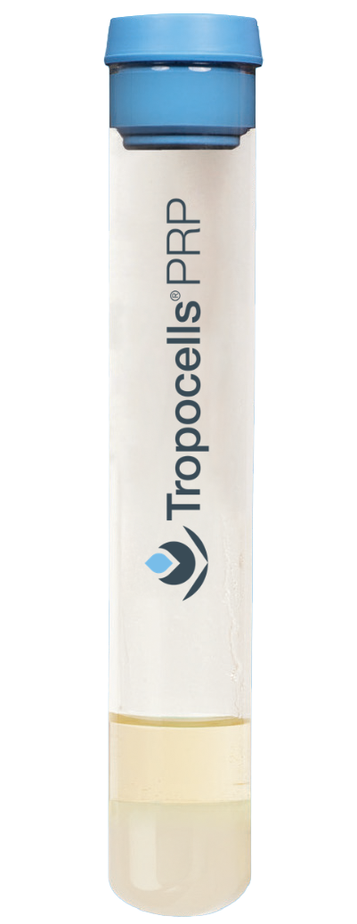 Tropocells™ PRP Blood Collection Tube, 11 ml