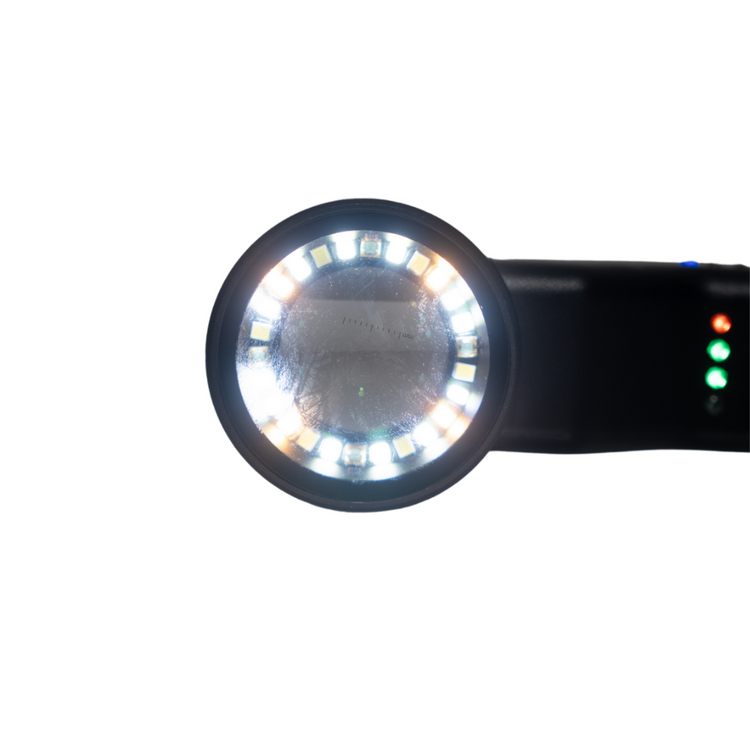 DelaScope™ Dermatoscope