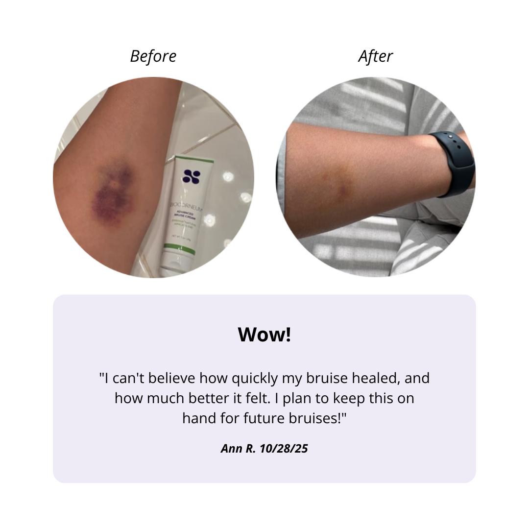 BIOCORNEUM® Advanced Bruise Cream