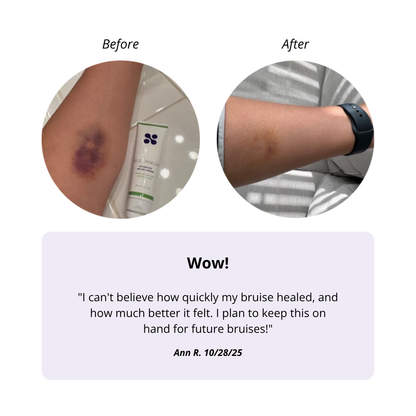 BIOCORNEUM® Advanced Bruise Cream