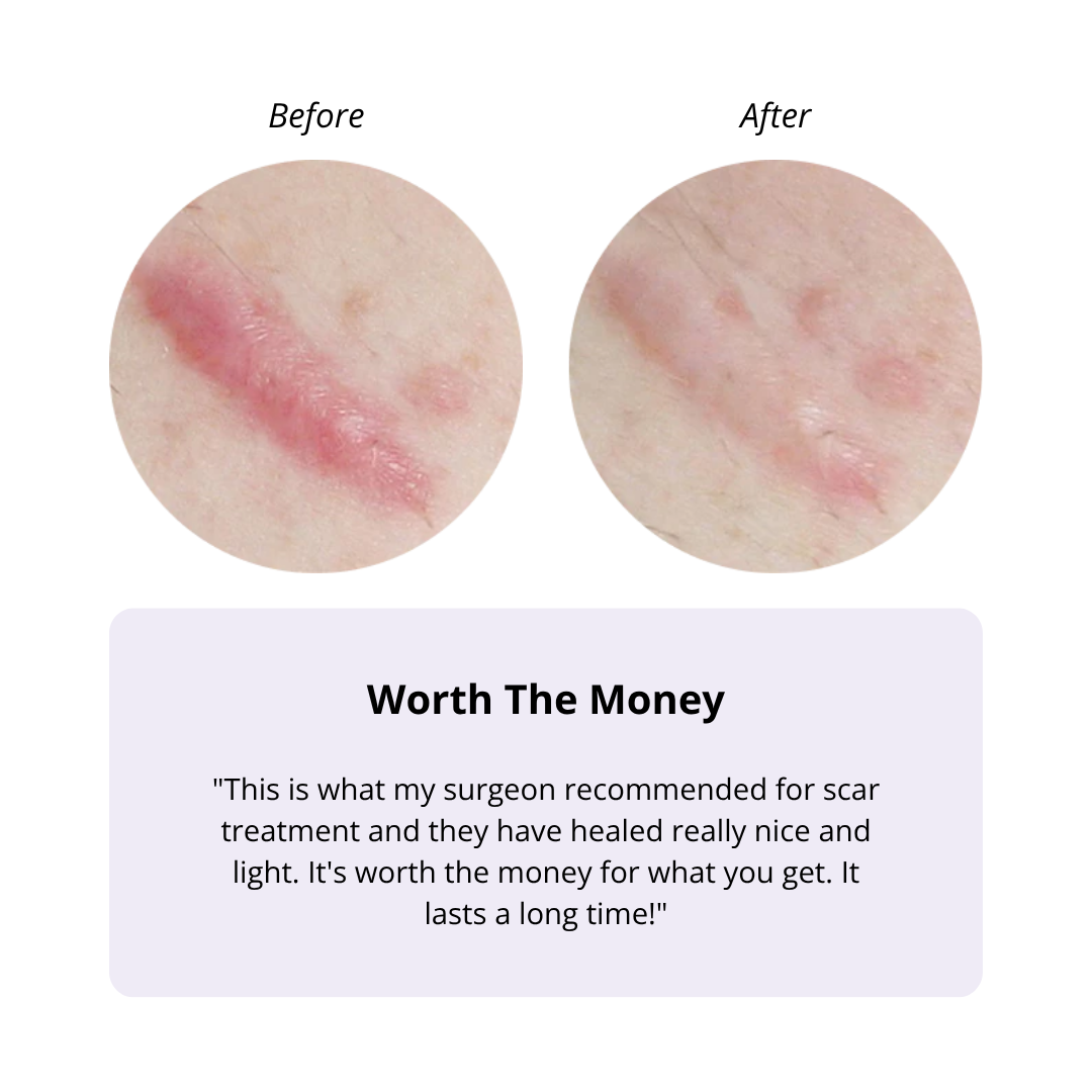 BIOCORNEUM® SiliShield Advanced Scar Gel with SPF 30