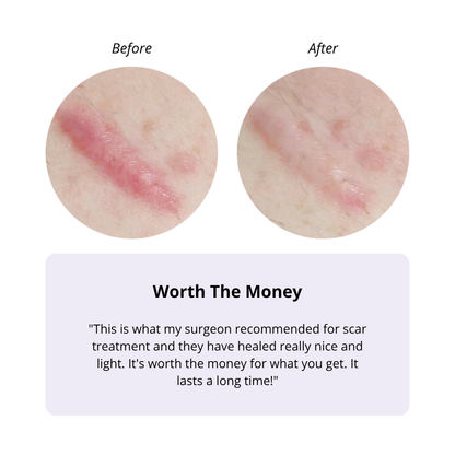 BIOCORNEUM® SiliShield Advanced Scar Gel with SPF 30