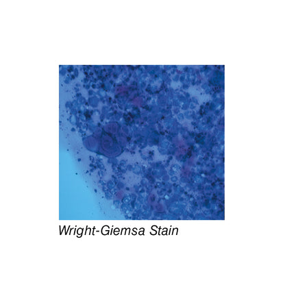 Wright-Giemsa Stain