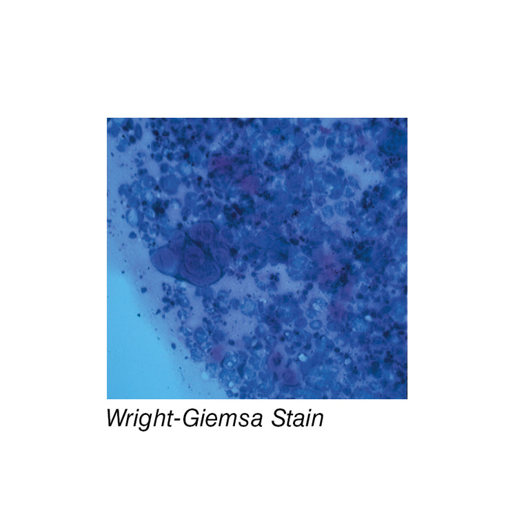Wright-Giemsa Stain