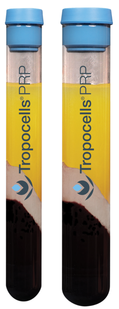 Tropocells™ PRP System Accessories Kit, 22 ml