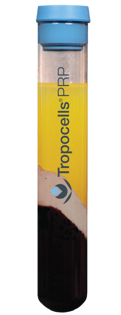 Tropocells™ PRP Blood Collection Tube, 22 ml